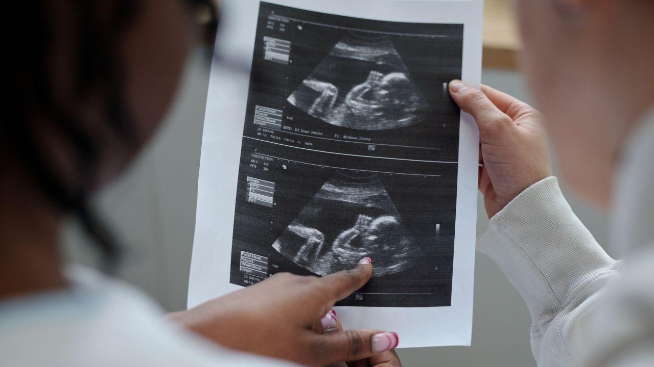 Columbia’s STAR AI Detects Rare Sperm, Enables Conception After 19 Years