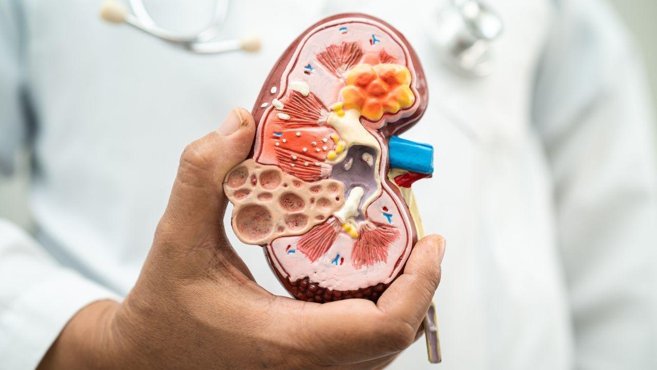 India Reports Alarming Rise in Chronic Kidney Disease Cases for 2023