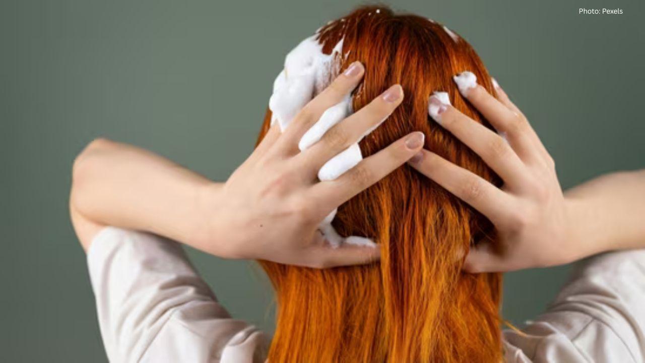 Top 8 Anti-Dandruff Shampoos for a Healthier Scalp