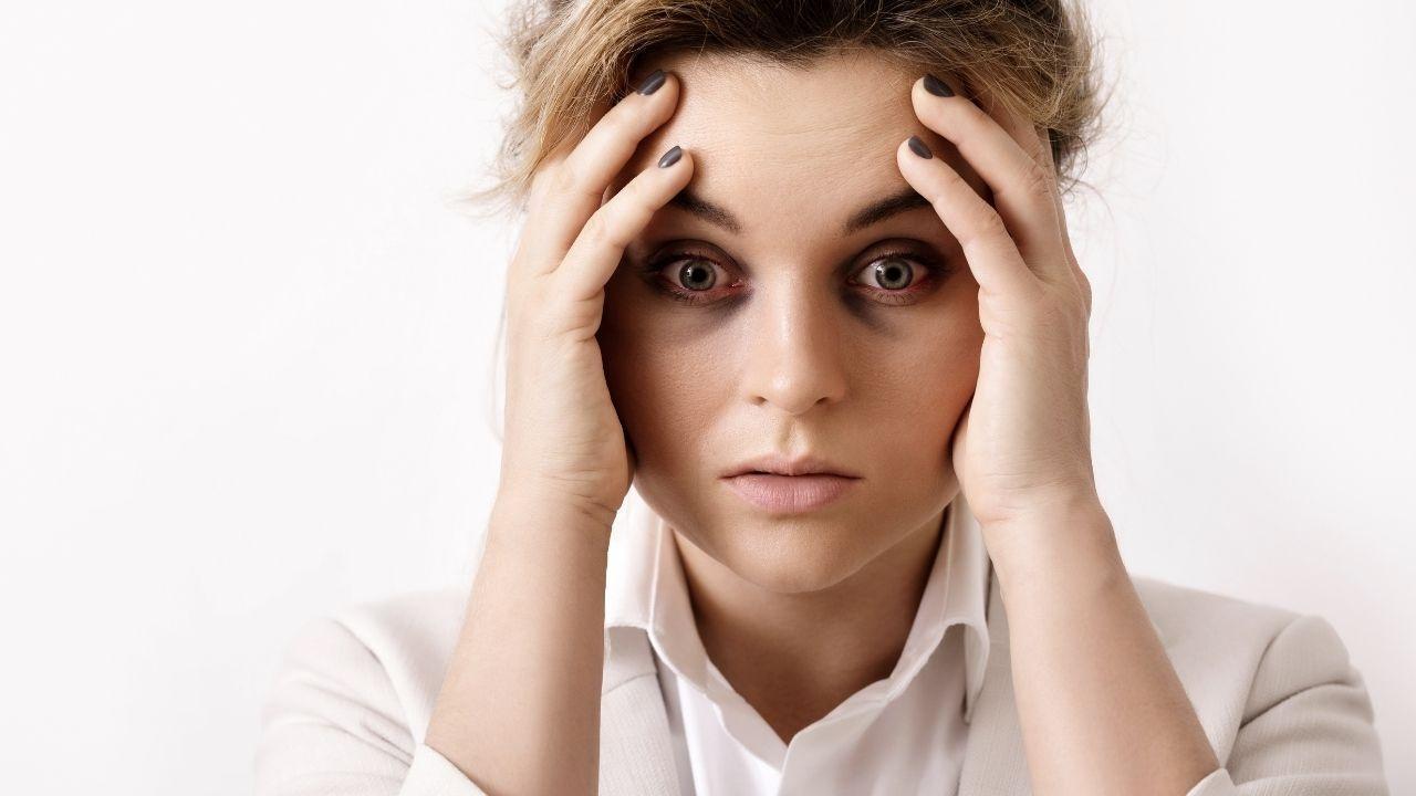 Eliminate Dark Circles: 10 Effective Home Remedies You Can Try