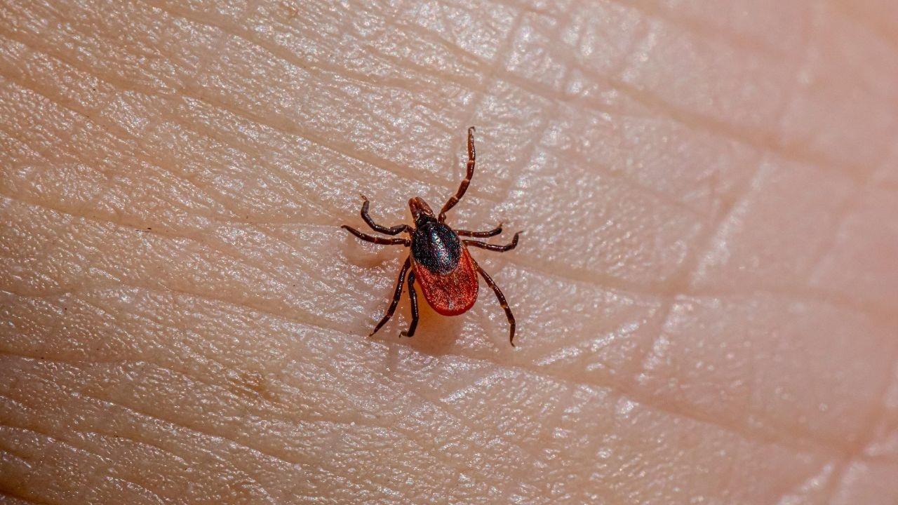 First Fatal Case of Alpha-Gal Meat Allergy Confirmed in the US