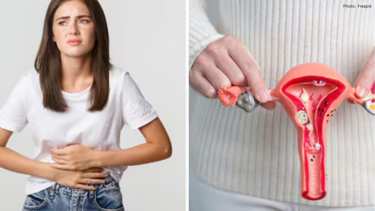 Bengaluru IT Professional Uncovers Massive Silent Fibroids During Health Assessment