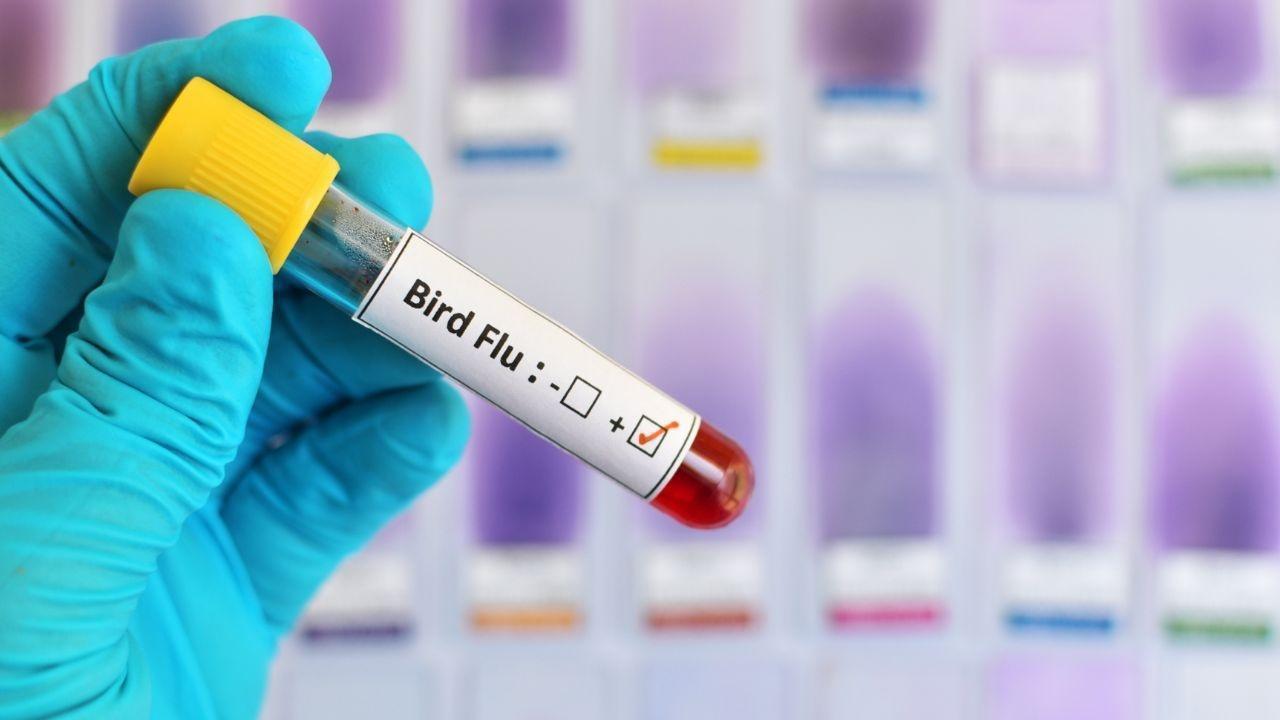 First Human Case of H5N5 Bird Flu Confirmed in the US