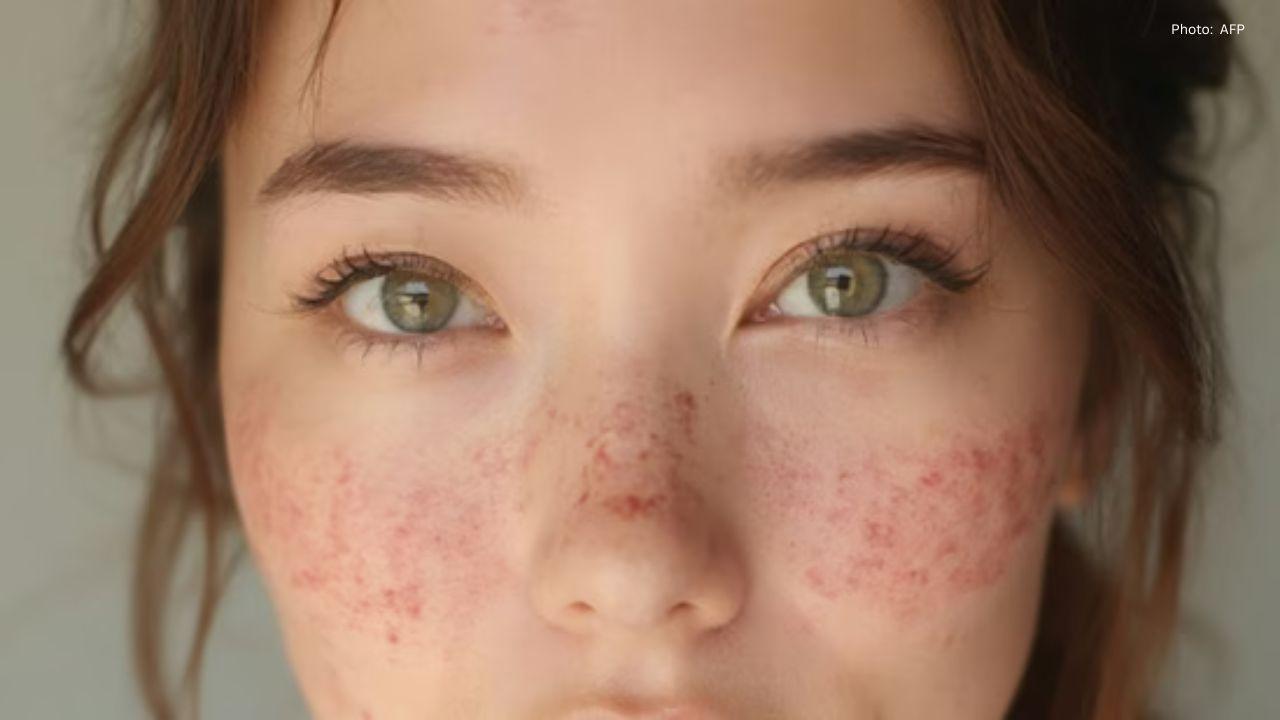 Essential Tips for Selecting the Ideal Winter Moisturizer for Healthy Skin