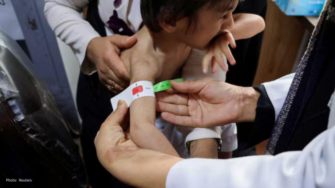 Afghanistan Faces Worsening Hunger Crisis as Aid Funds Dry Up, Warns UN