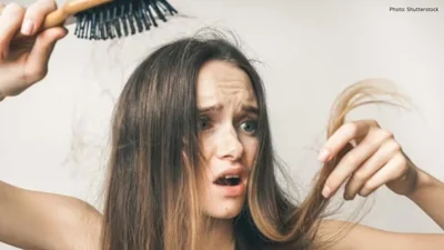 Why Hair Fall Often Increases After 30: Doctors Explain the Real Reasons