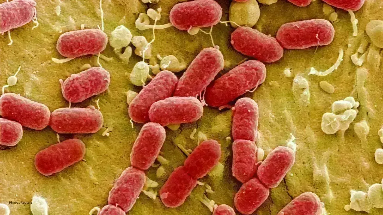 Rising Salmonella Cases Linked to Hamilton Eatery