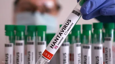 Third British National Linked to Hantavirus Outbreak o…