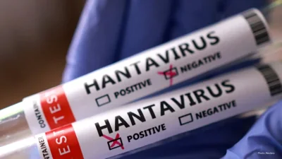 Canada's Health Authority Confirms Low Risk of Hantavirus Pandemic