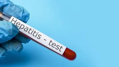 Hepatitis A Outbreak Escalates in Rural Manitoba Communities